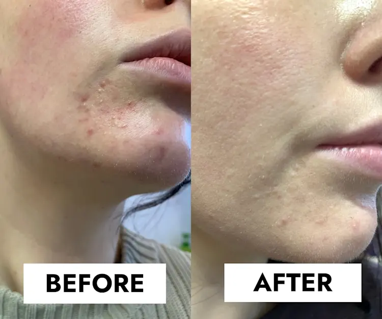 adore beauty article image
