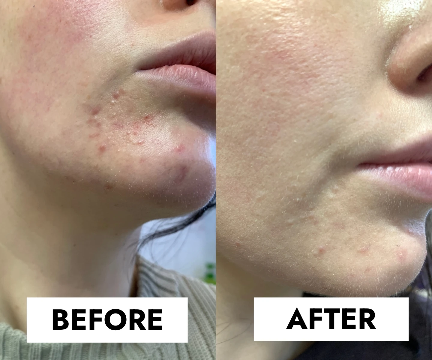 adore beauty article image