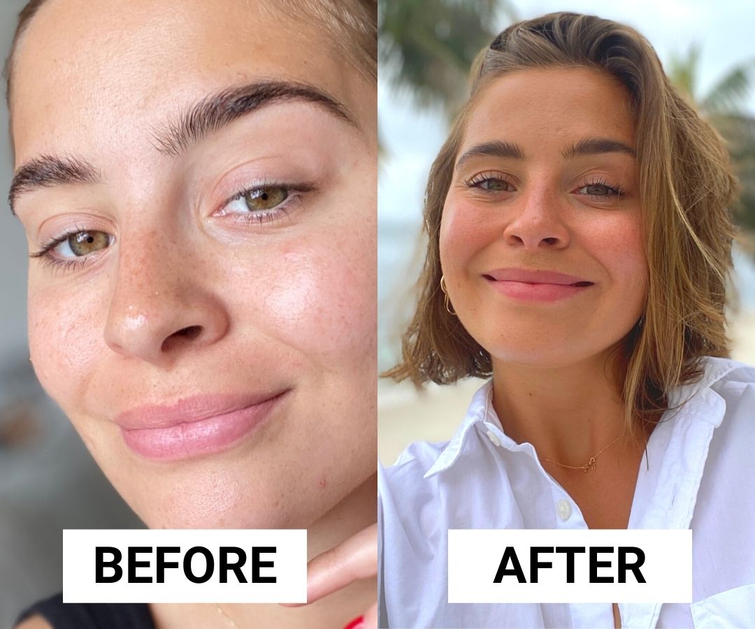 before and after tan face