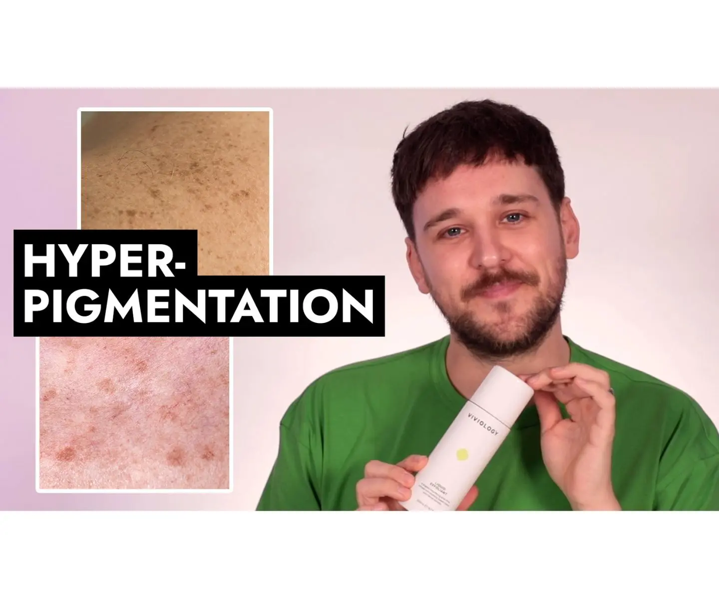 VIDEO: Top 6 best products for hyperpigmentation 