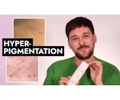 VIDEO: Top 6 best products for hyperpigmentation 