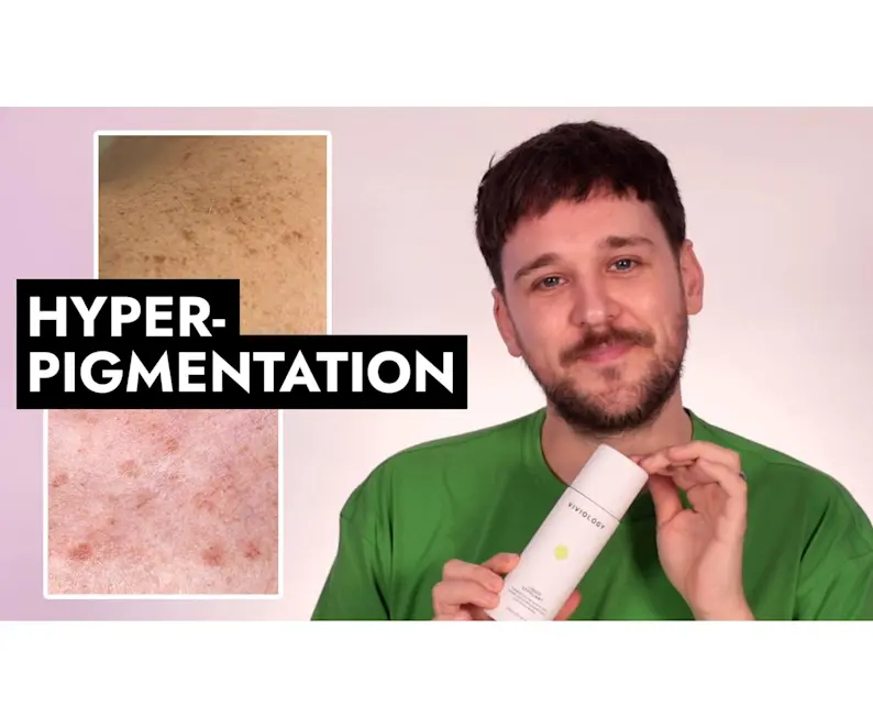 VIDEO: Top 6 best products for hyperpigmentation 