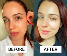 Beauty IQ Article - This Budget-Friendly Cleanser and Moisturiser Duo Healed My Breakouts in a Week