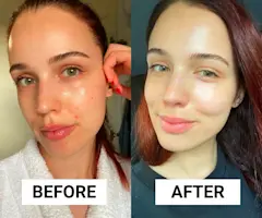 This Budget-Friendly Cleanser and Moisturiser Duo Healed My Breakouts in a Week