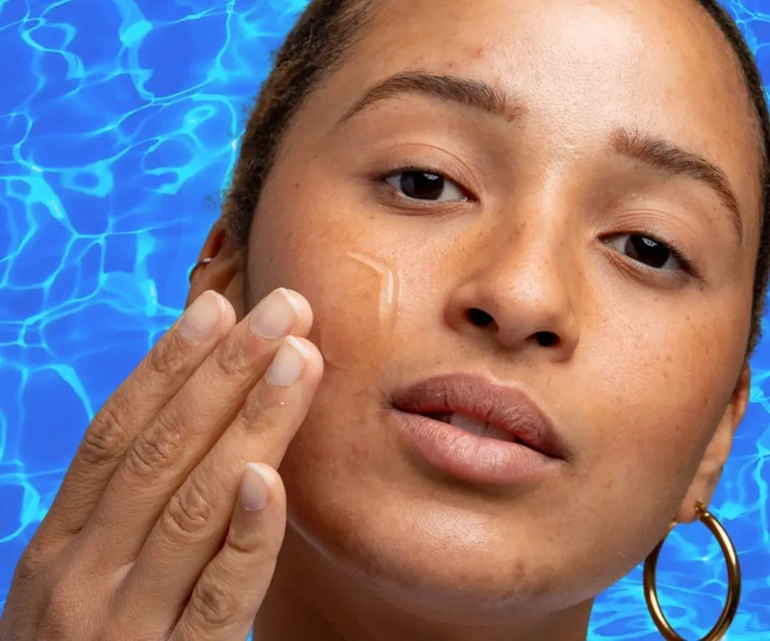 Sorry, but Summer Acne Is a Thing - Here Are 4 Ways to Avoid It