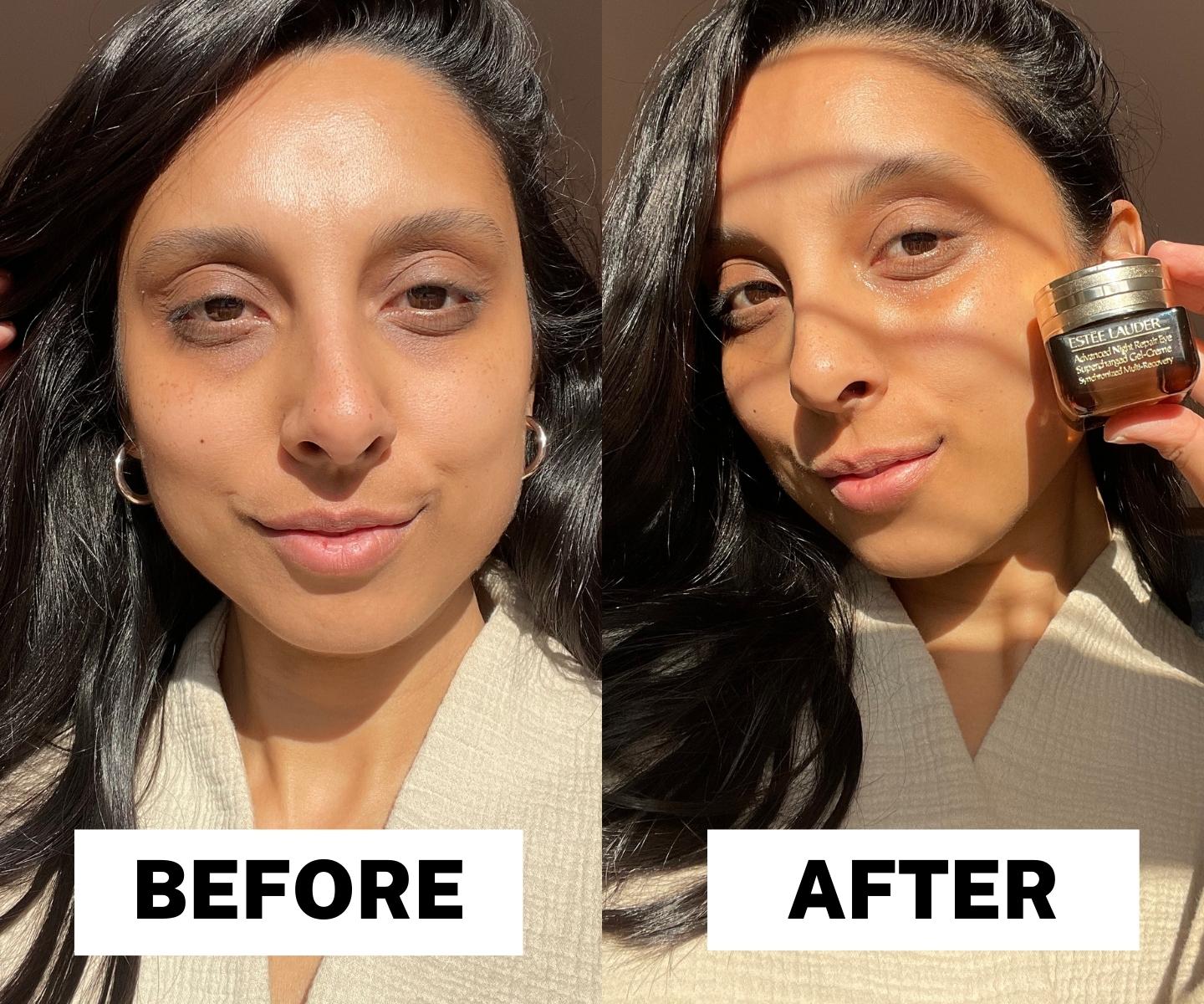 Estée Lauder Advanced Night Repair Eye Supercharged eye cream review before and after picture