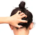 How Can I Treat My Dry, Itchy Scalp?