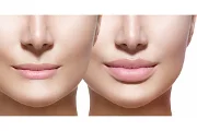 How Do I Make Thin Lips Look Fuller?
