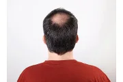 How Do Viviscal Dietary Hair Supplements Work?