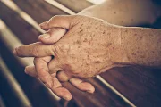 What is Skin Hyperpigmentation?
