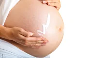 When During Pregnancy Should I Start Using Stretch Mark Cream?