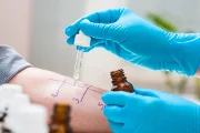 Can My Doctor Test Me for Sensitive Skin?
