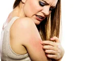 What Are the Symptoms of Eczema?