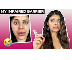 VIDEO: How I fixed my DESTROYED skin barrier in a week!