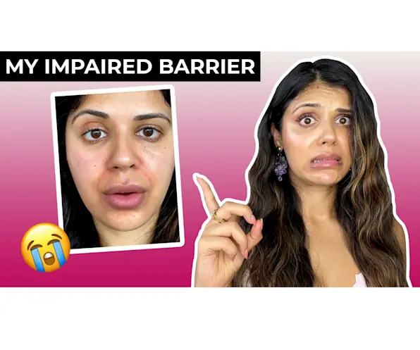 VIDEO: How I fixed my DESTROYED skin barrier in a week!