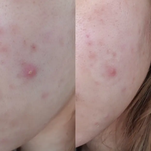 adore beauty article image