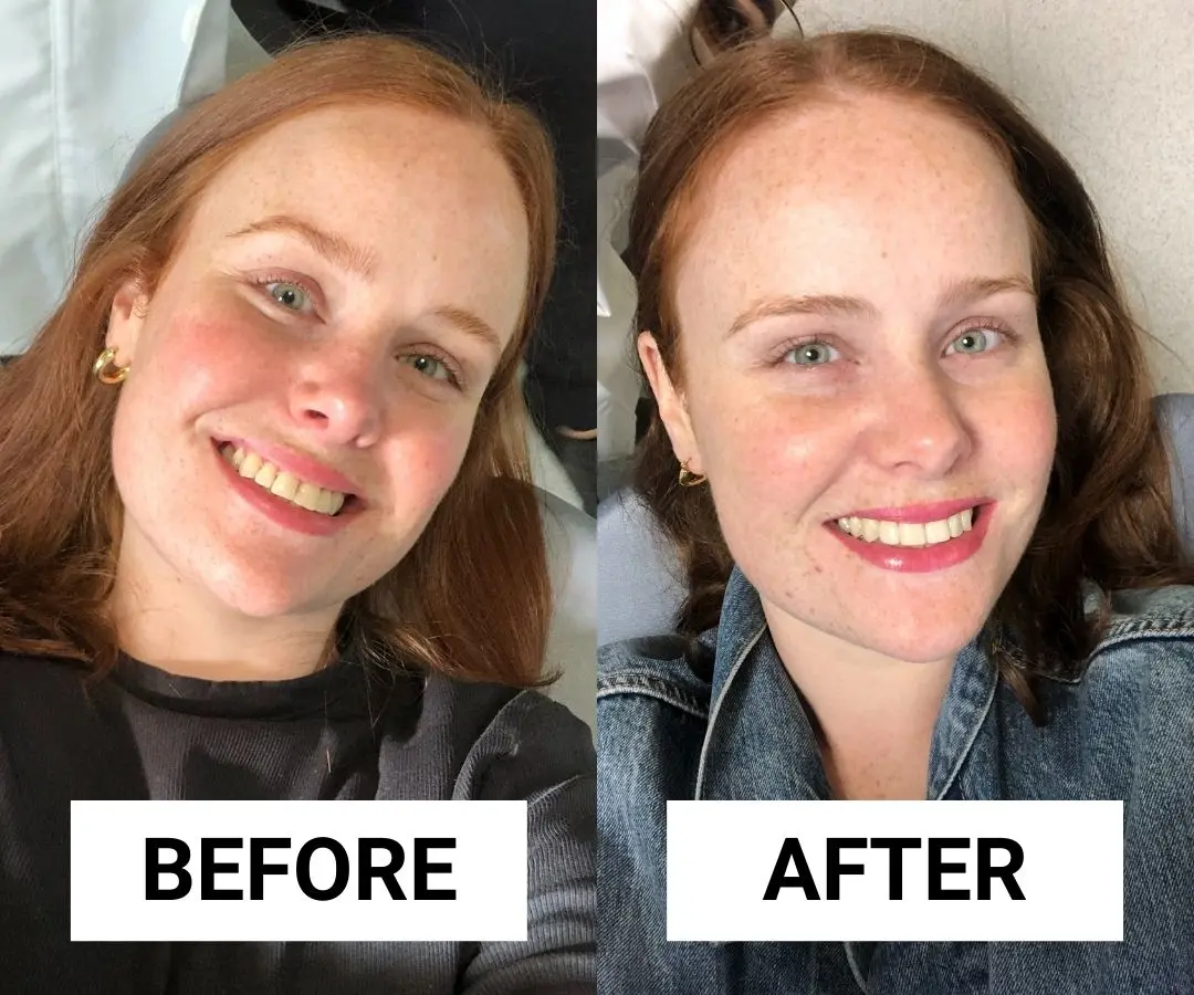 adore beauty article image
