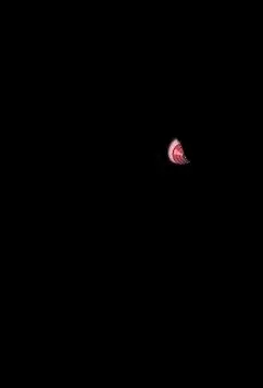 red-eyes