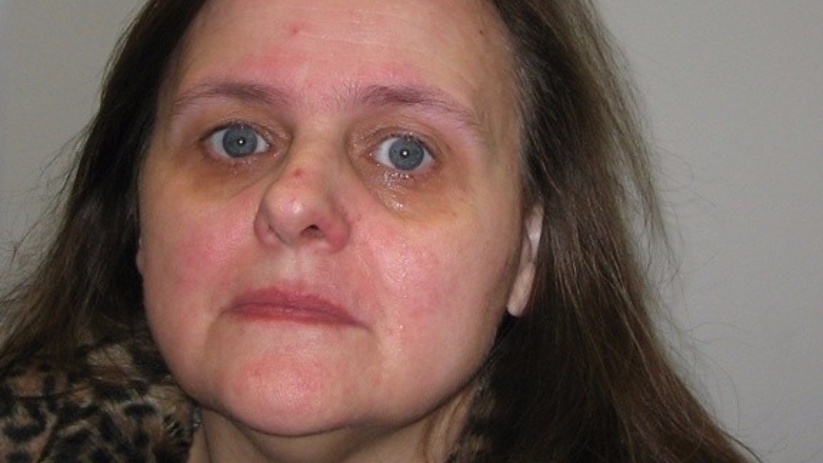 Wife Jailed For 15 Years After Trying To Poison Husband With Anti ...