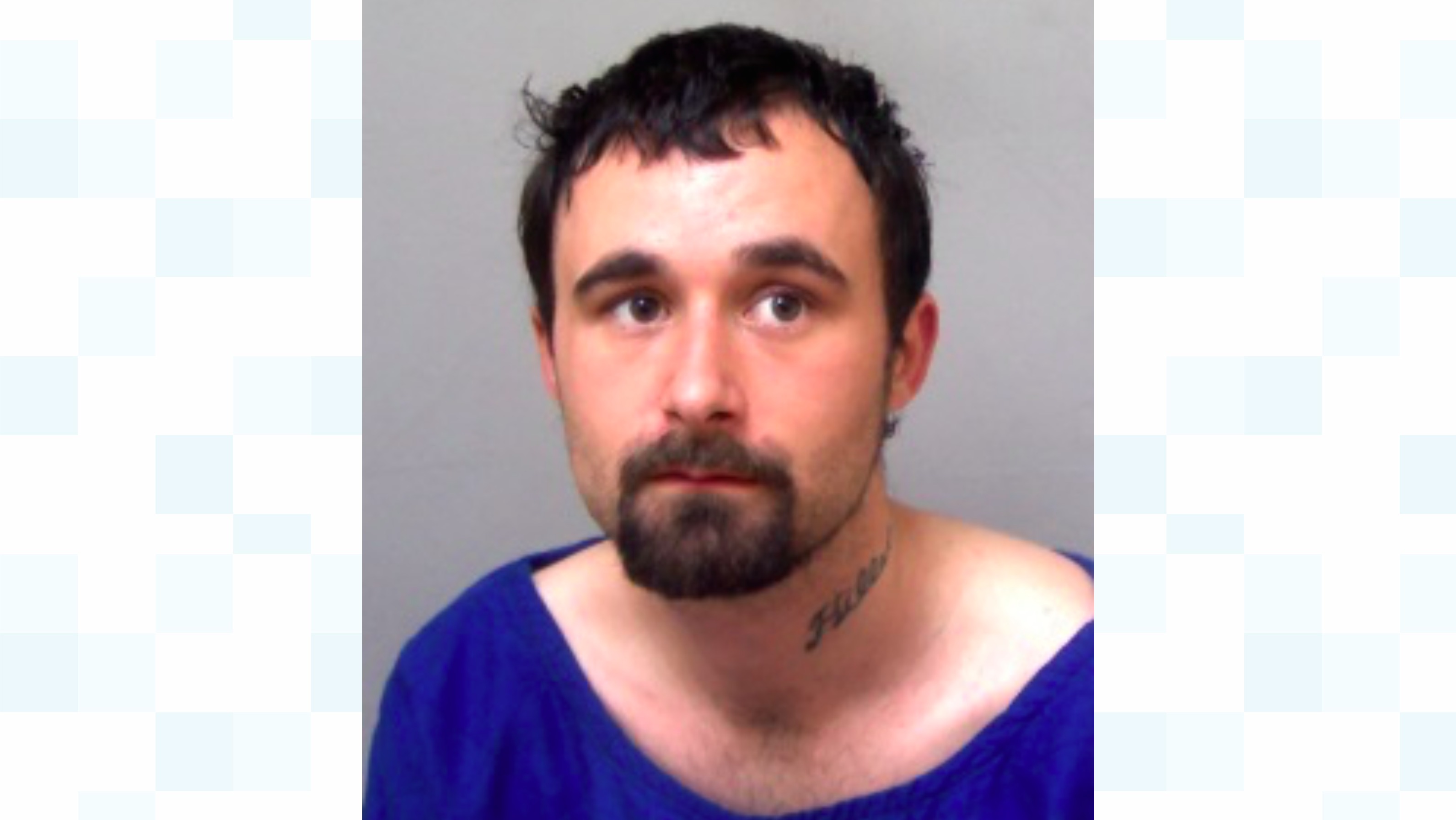Brutal Attack Leaves Man Nose Less - exm1zj6