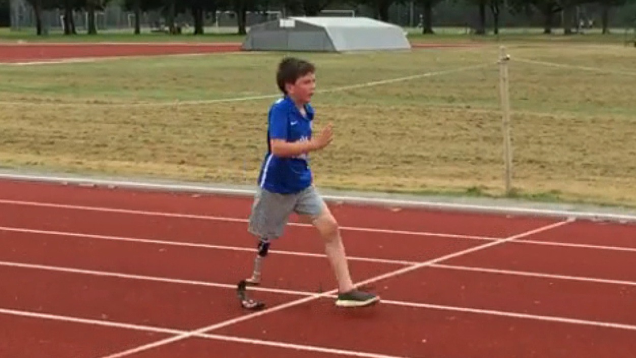 Call for better safety rules after boy loses leg falling from coach