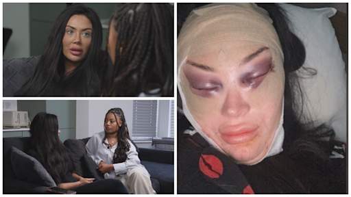 'She cut me with scissors': Inside the UK's underground cosmetic surgery network