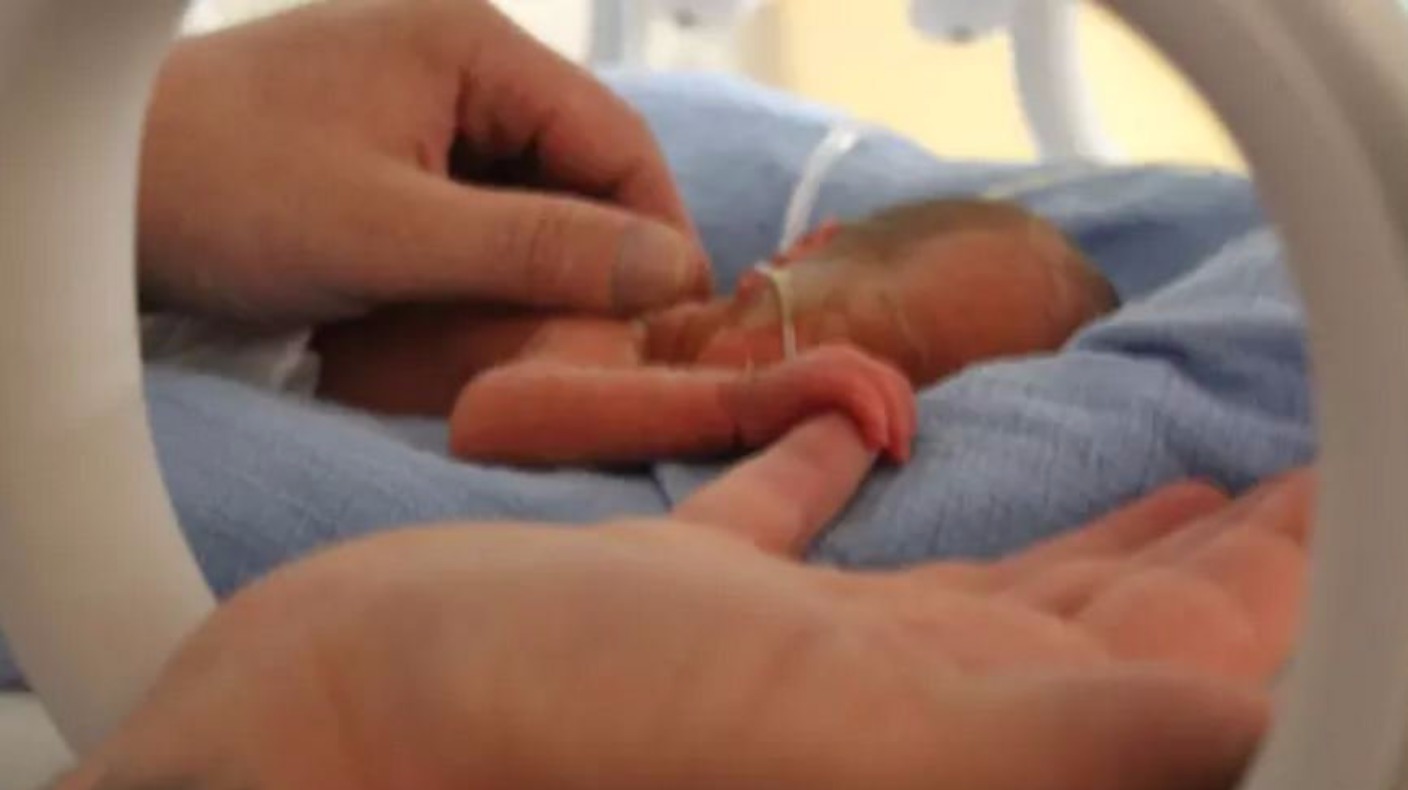 can a baby born 10 weeks early survive