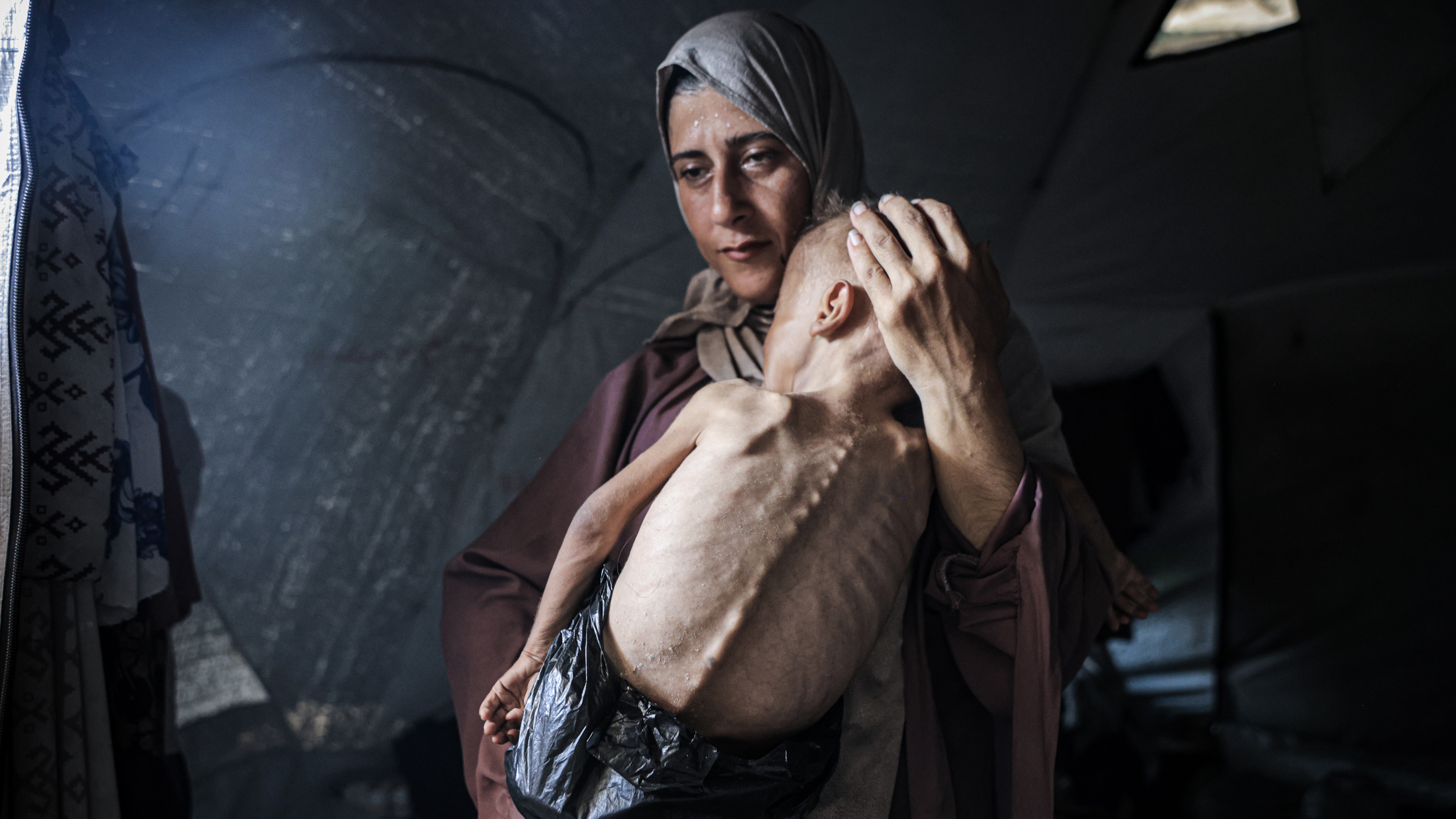 'Man-made mass starvation' gripping Gaza and killing children, WHO says