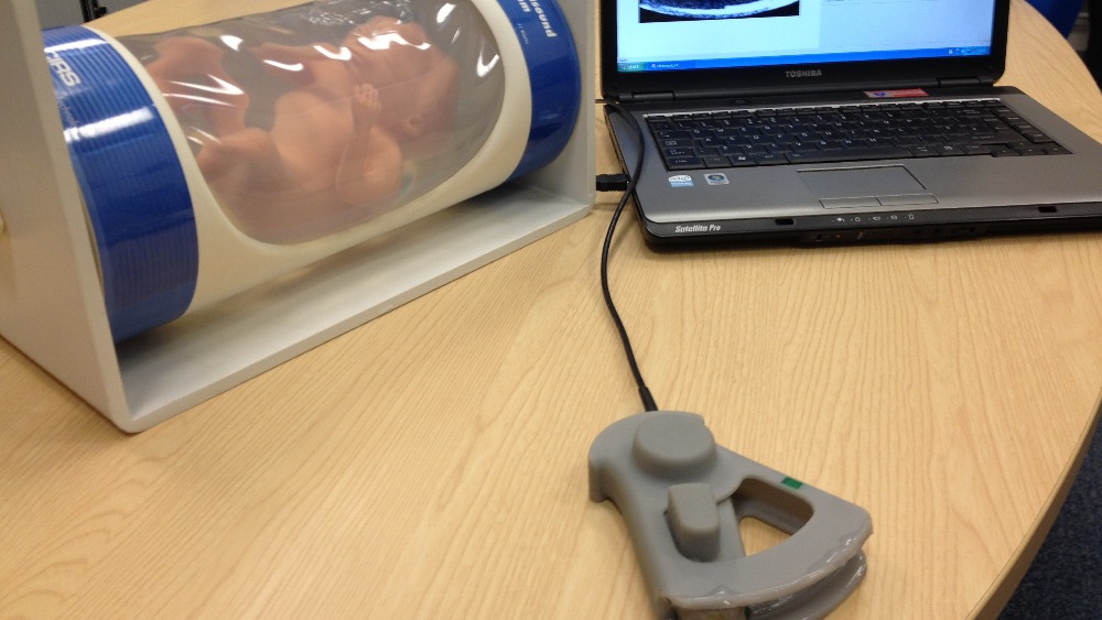 Newcastle scientists develop lifesaving ultrasound scanner ITV News