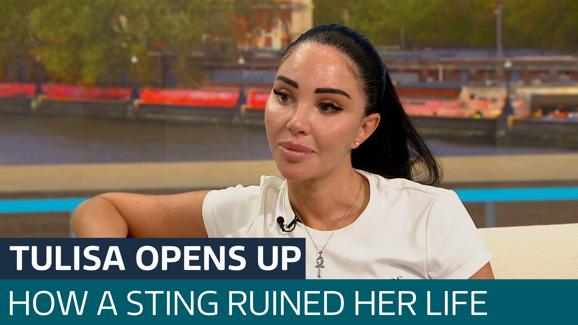 Tulisa opens up on tabloid drug sting that derailed her life