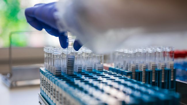 Gloved Technician Selecting Sample Vials From Rack, Workstation Bathed In Natural Light With Labeled Tubes,