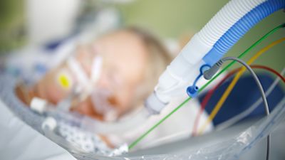 Ventilation tubes are seen in front of an intubated Corona patient in an intensive care bed room at a hispital in Bavaria.
Copyright: PA