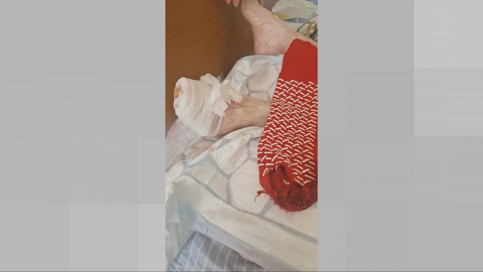 Disbelief as rat chews off toe of 88-year-old Southampton woman | ITV ...