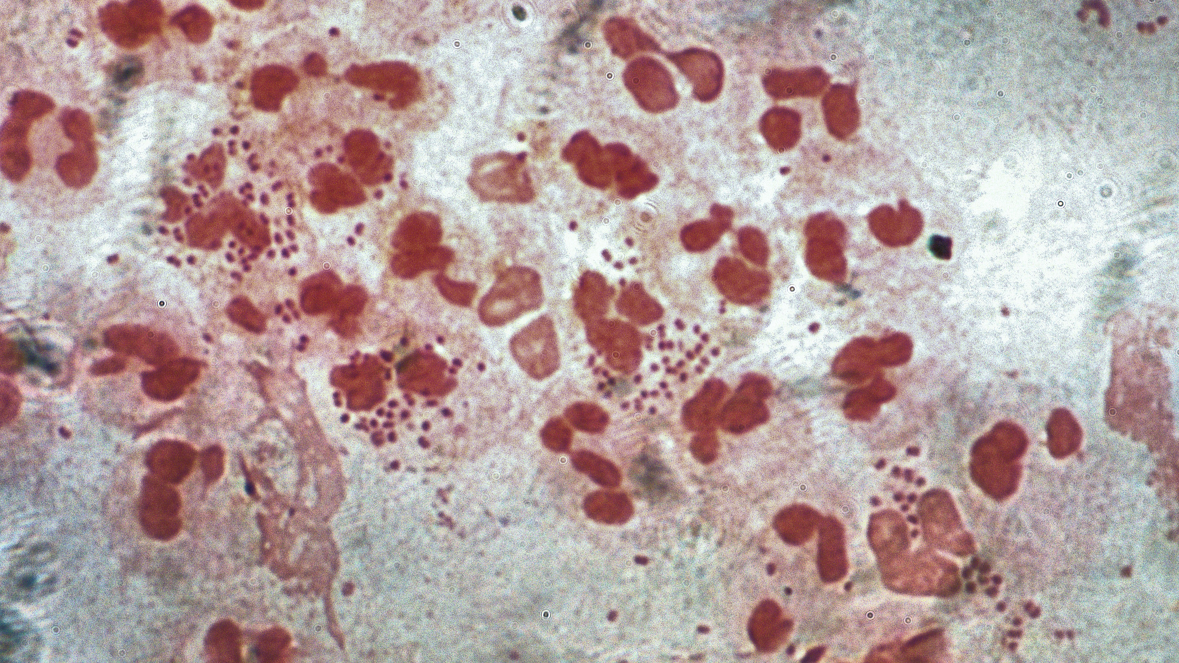 AI designs drugs to combat gonorrhoea and MRSA