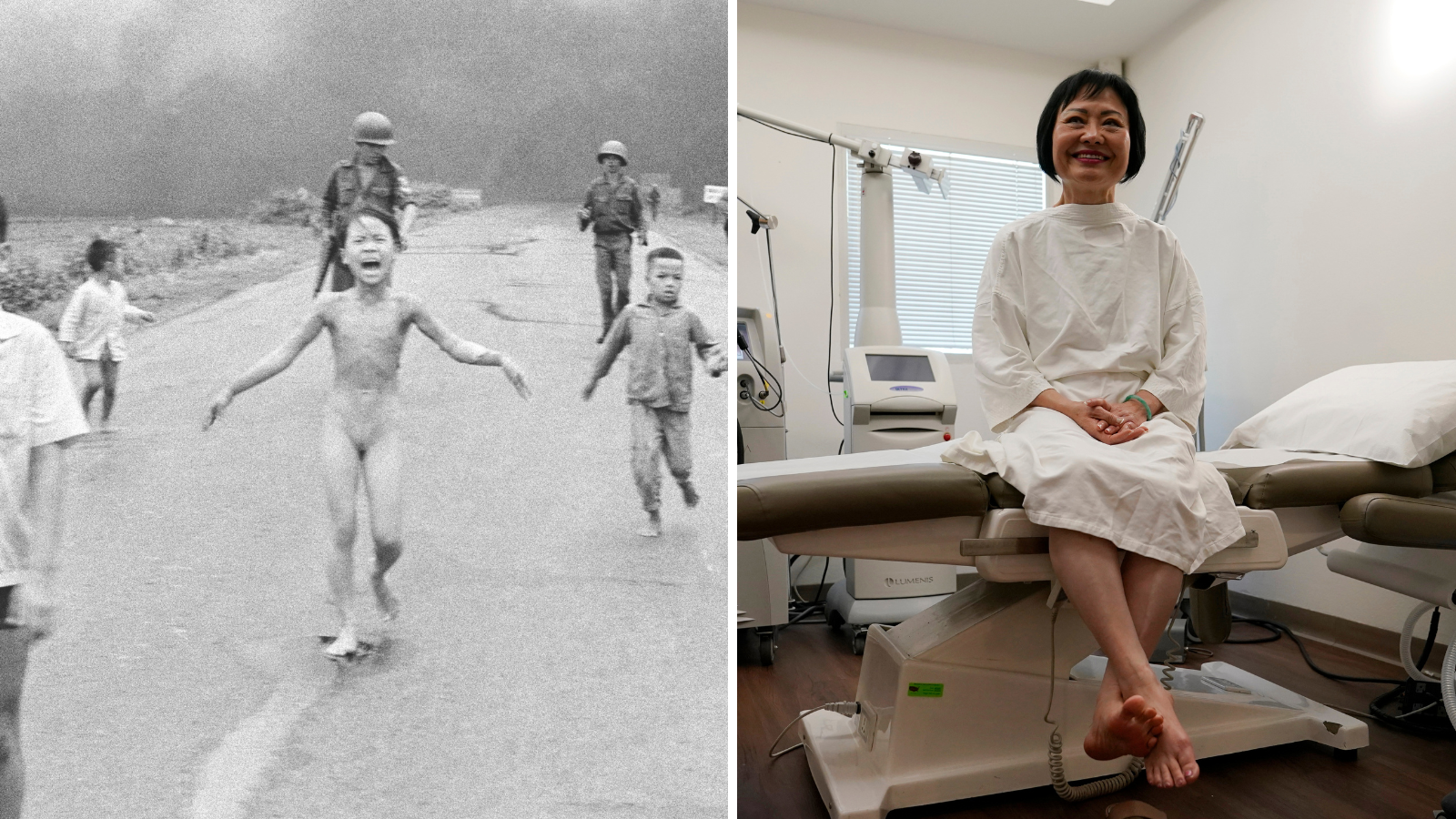 Vietnam Napalm Girl receives final skin treatment 50 years after