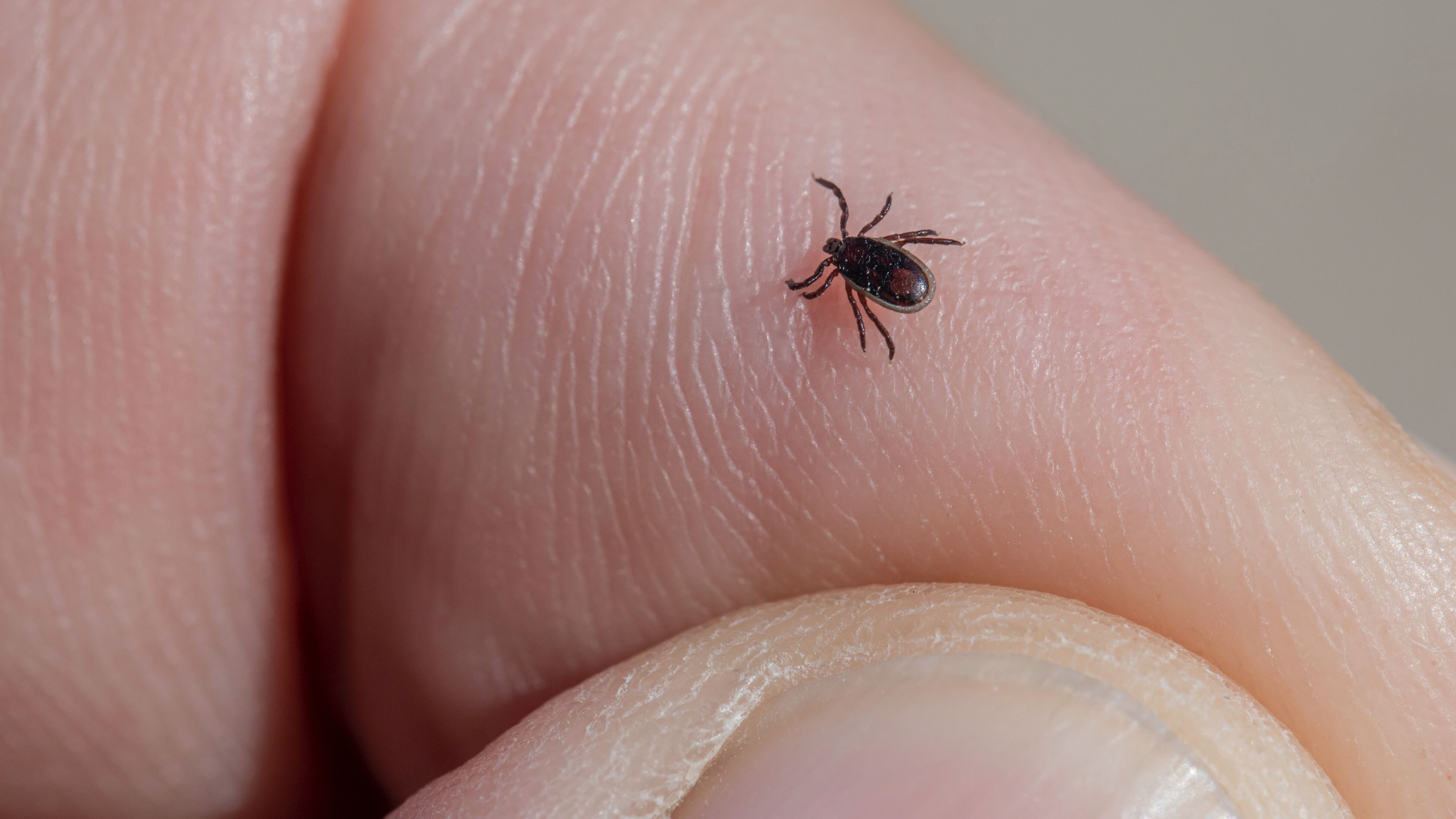 Deadly tickborne virus 'likely' to be in UK after first case detected in Yorkshire ITV News