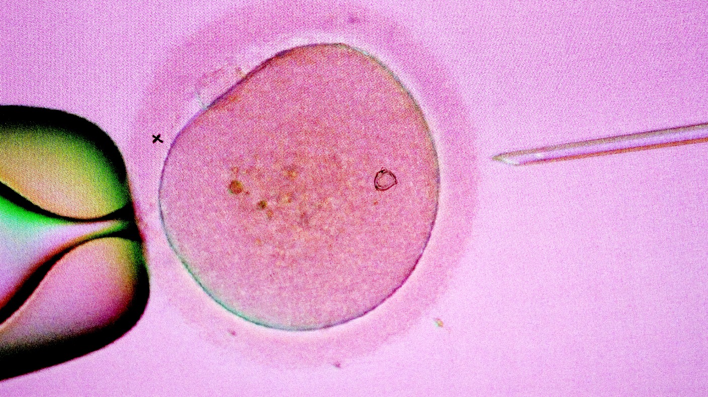 Jersey government plans to provide free IVF treatment to all women