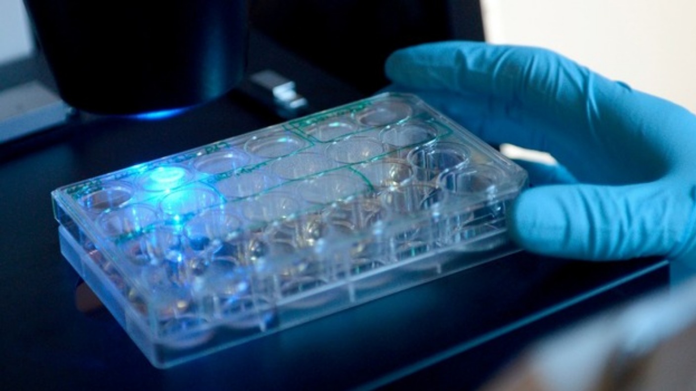 Almost half of people in Wales ignore bowel cancer test ITV News Wales