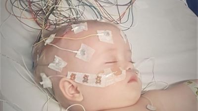 ANGLIA 230324 Oscar Crane brain tumour baby