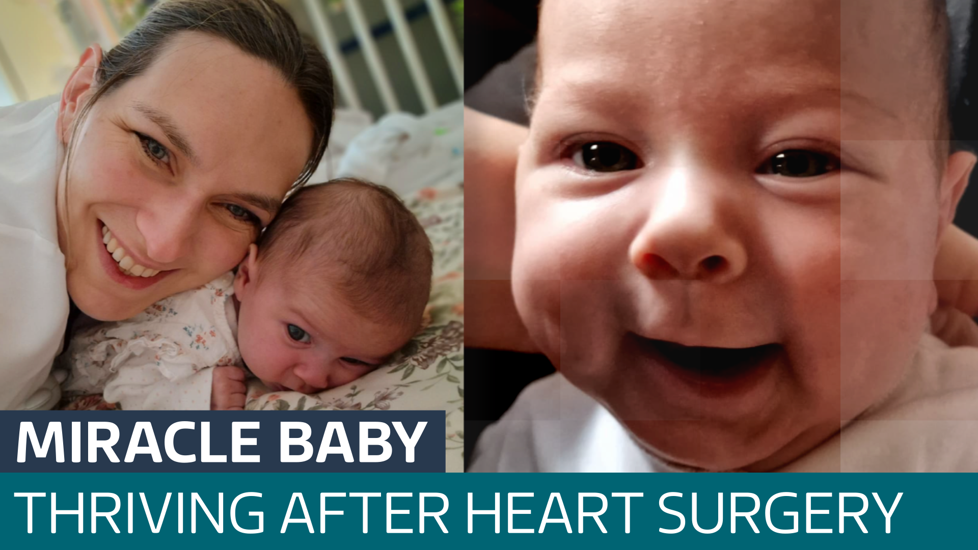 A baby born with half a heart has defied the odds by surviving