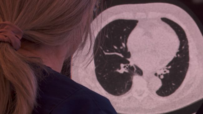 Nurse looks at screening image