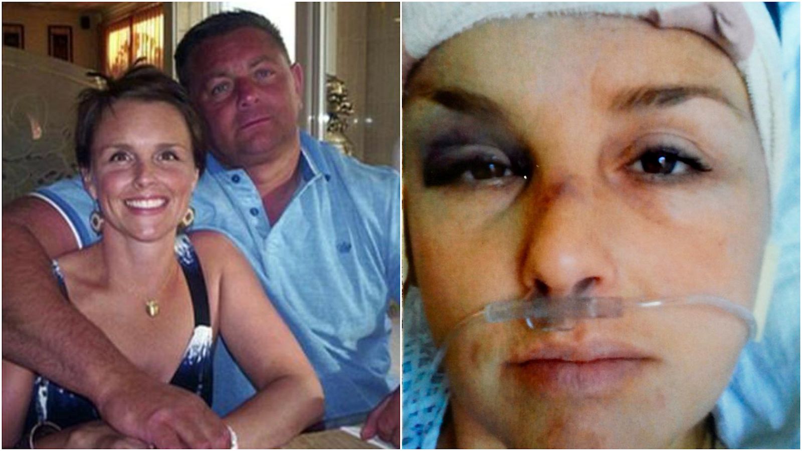 Real Domestic Violence Pictures Domestic Violence Survivors Being