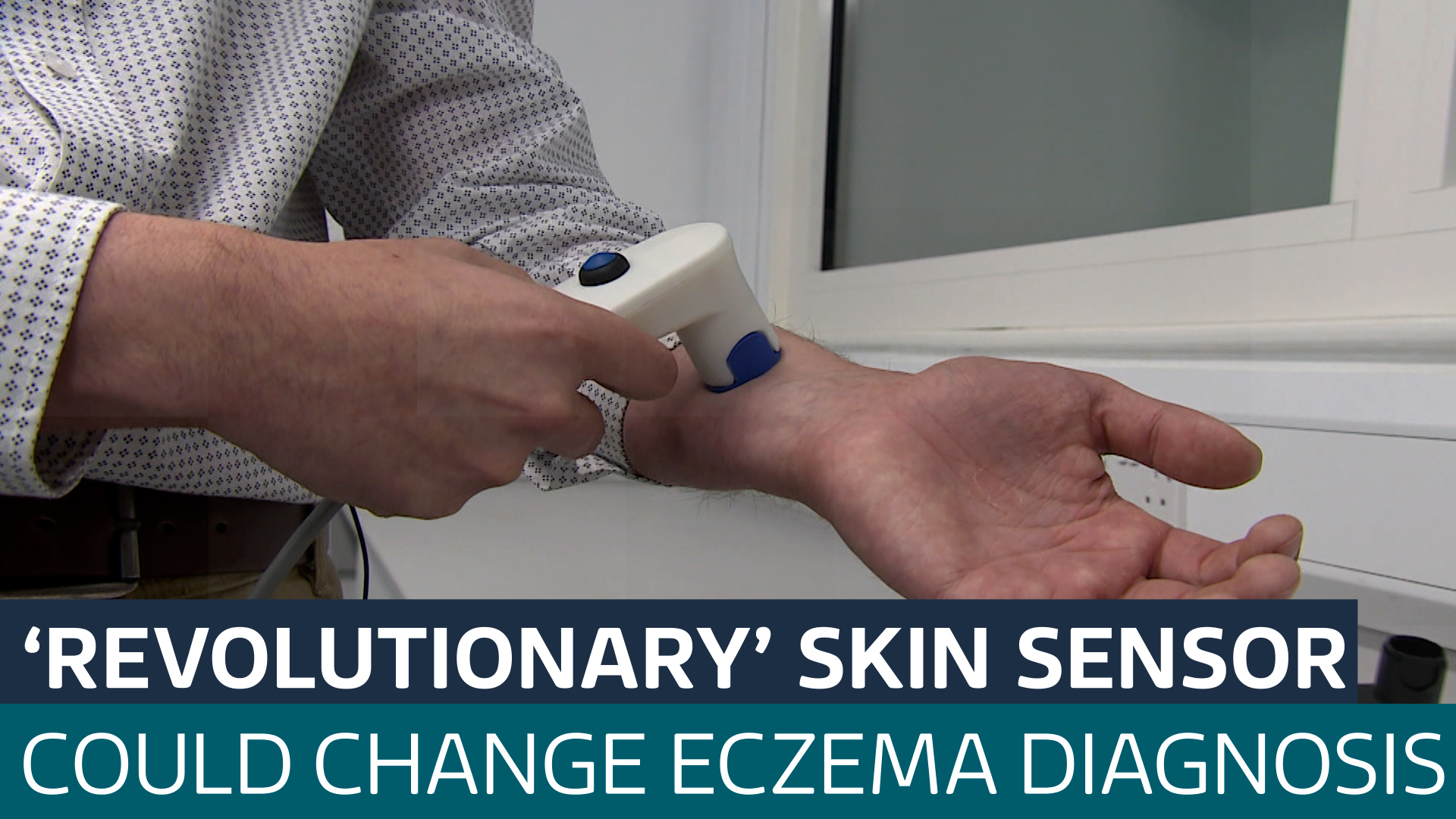 'Revolutionary' skin sensor could change how eczema is treated - Latest ...