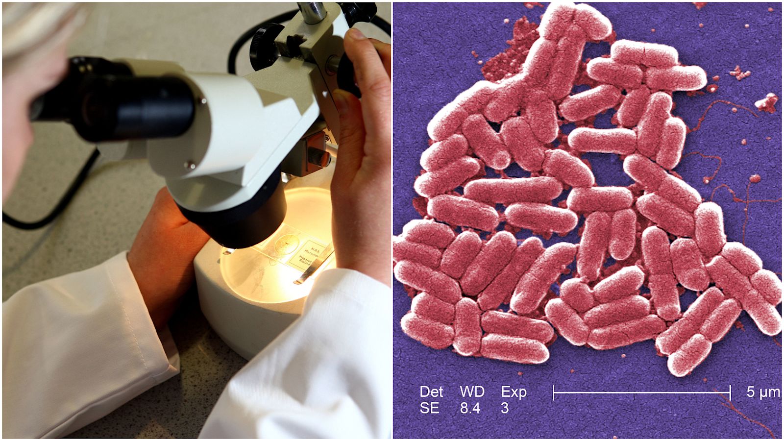 UKwide E.coli outbreak What do we know so far? ITV News