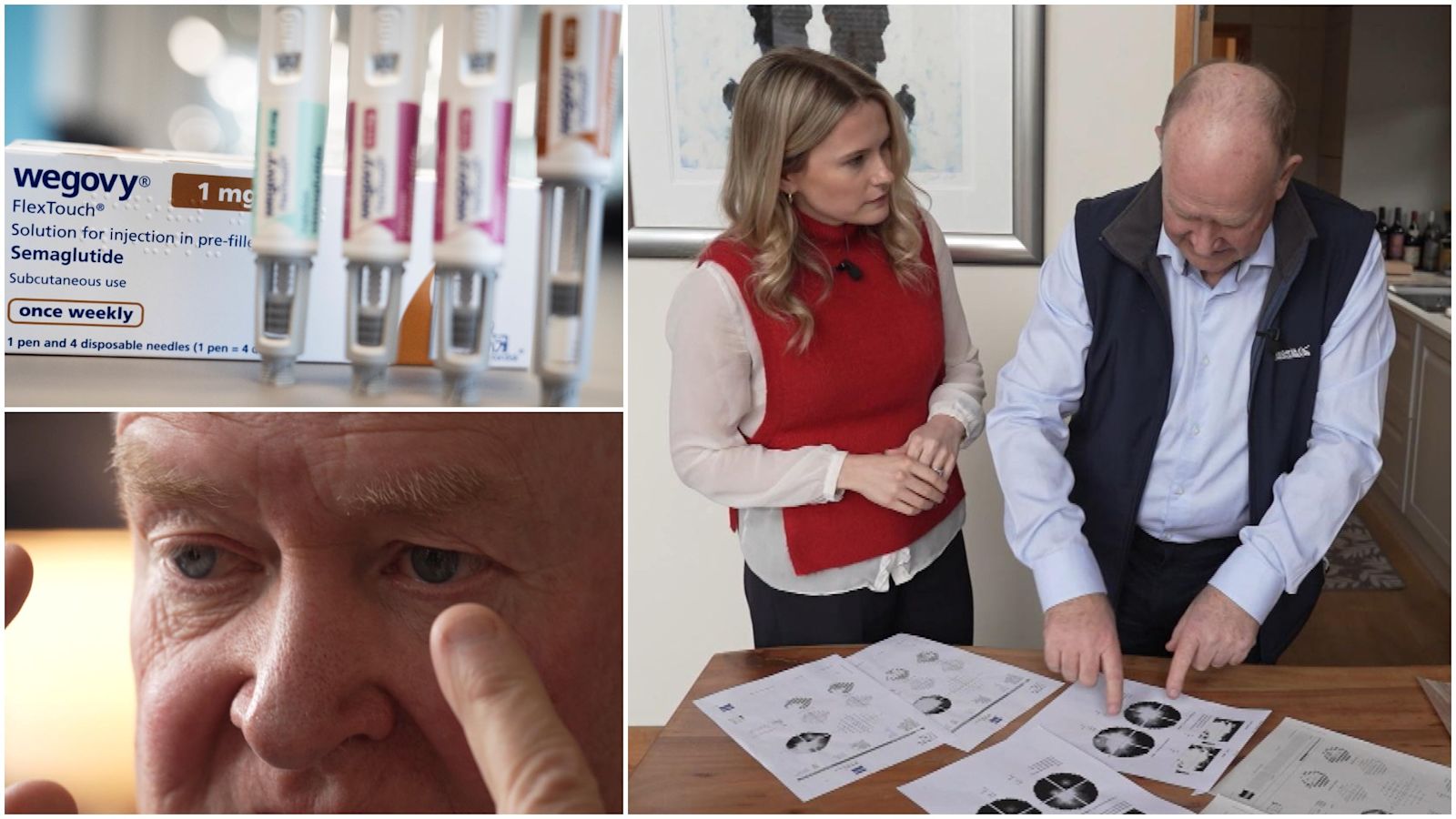 can you go blind from semaglutide Ozempic and Wegovy Side Effects Linked To BLINDNESS? Ozempic side effects LEAD TO
