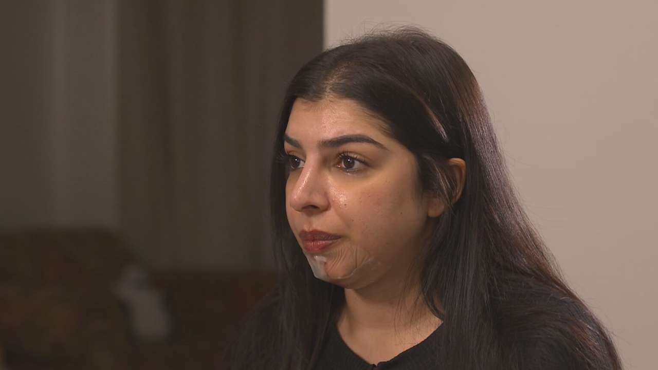 Calls for tighter laws on cosmetic injectables after woman left scarred for life