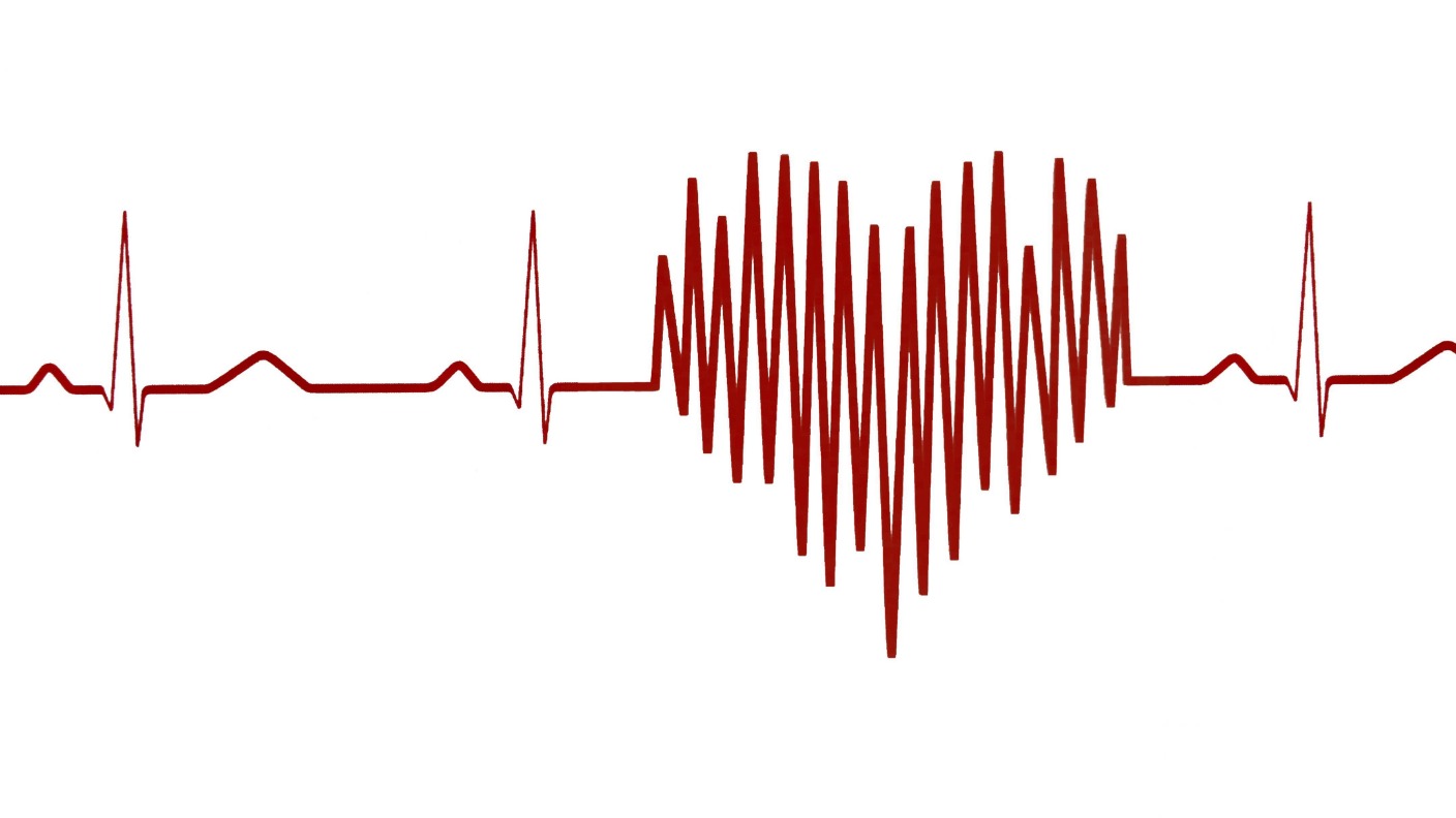 Scientists Continue Their Battle Against Heart Disease Itv News Granada