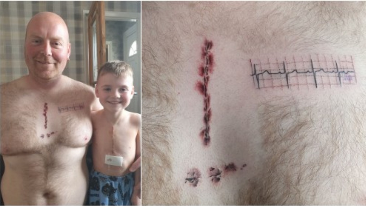 Dad supports son with heart surgery scar tattoo | ITV News Calendar
