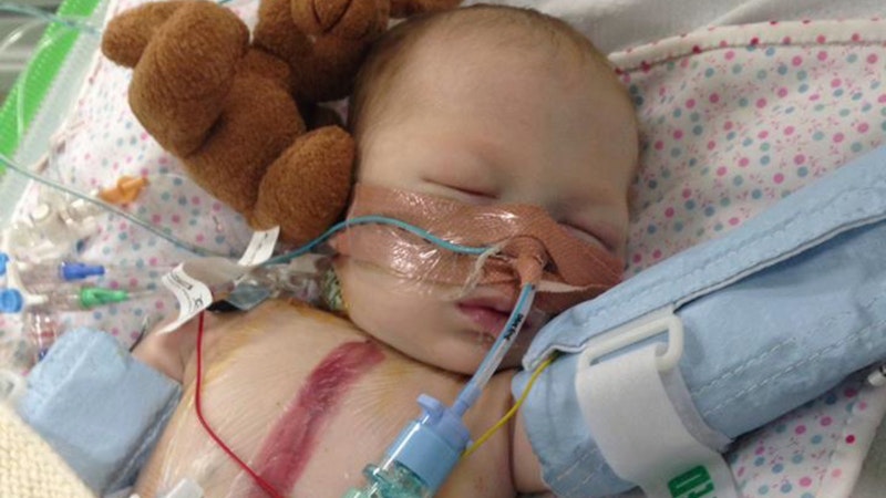 Doctors urge public to give views on heart defects test for newborns ...