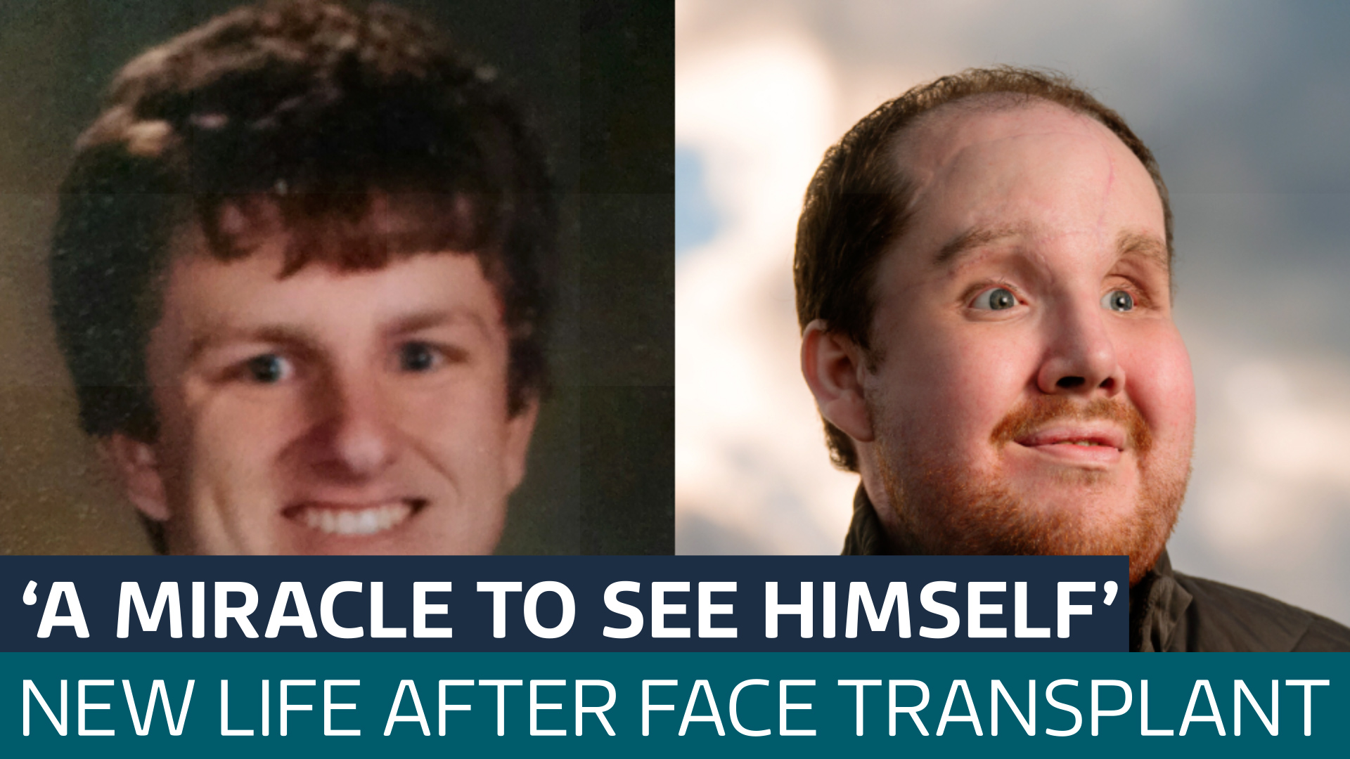 Man says he looks 'like a person again' after receiving life-changing ...